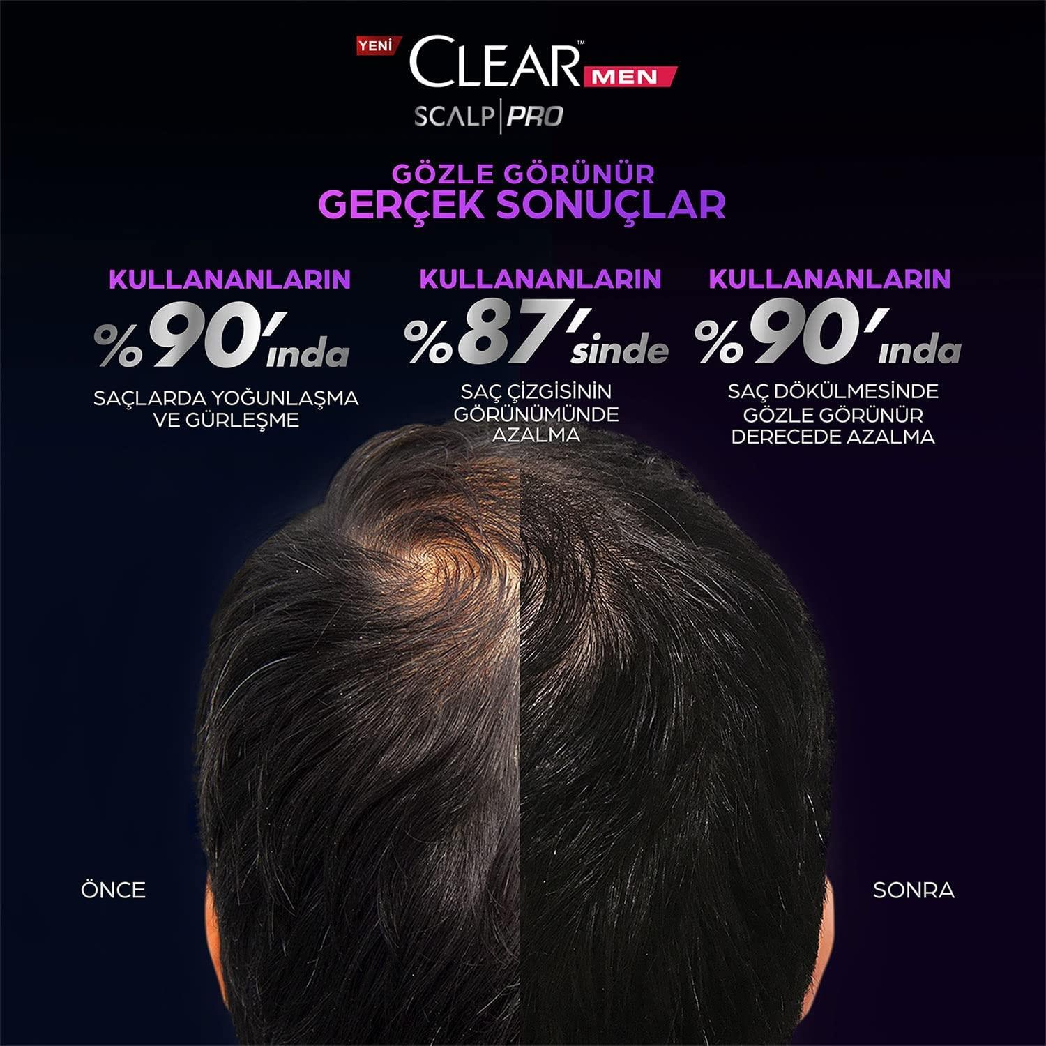 Clear Men Scalp Pro Saç Dökülmesine Karşı Güçlendirici Şampuan 300ML